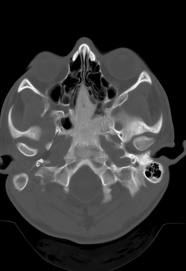 Teleradiology Case 022912 1