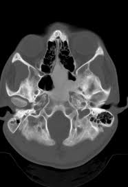 Teleradiology Case 022912 2