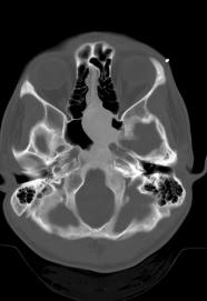 Teleradiology Case 022912 3