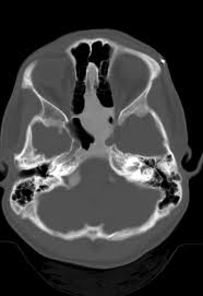 Teleradiology Case 022912 4