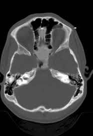 Teleradiology Case 022912 5