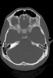 Teleradiology Case 022912 6